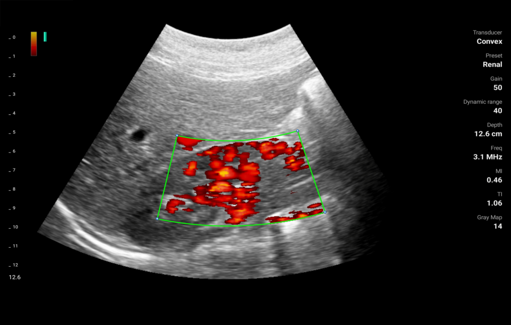 Ultrasound Modes