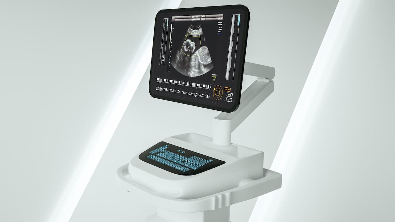 Ultrasound Systems: Understanding the Technology Behind Diagnostic Imaging